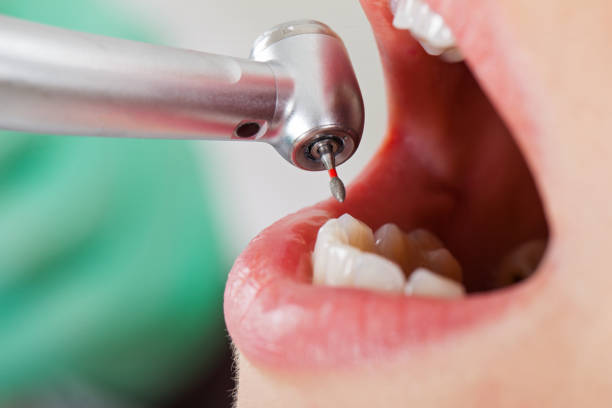 Best Pediatric Emergency Dentist in Dry Ridge, OH